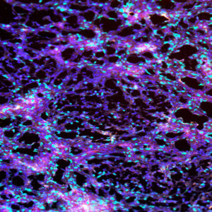 Diagnostic Screening for Biomarker Expression in 3D Cultures